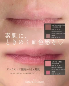 amarapink_tokyoの投稿5