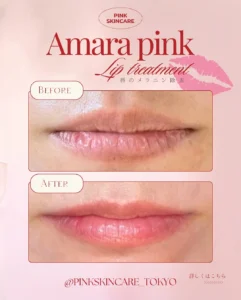 amarapink_tokyoの投稿7