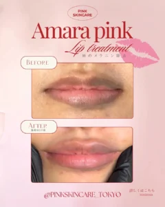 amarapink_tokyoの投稿9