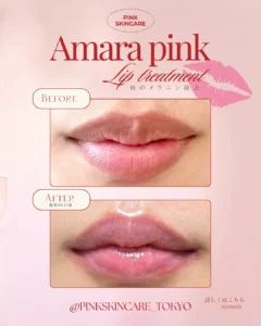 amarapink_tokyoの投稿10