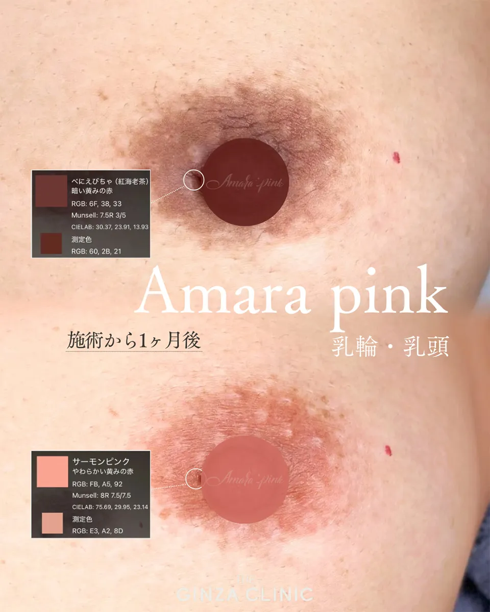 slide-2