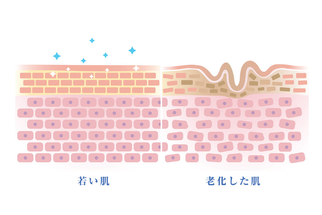ほうれい線はなぜできる?改善のポイント