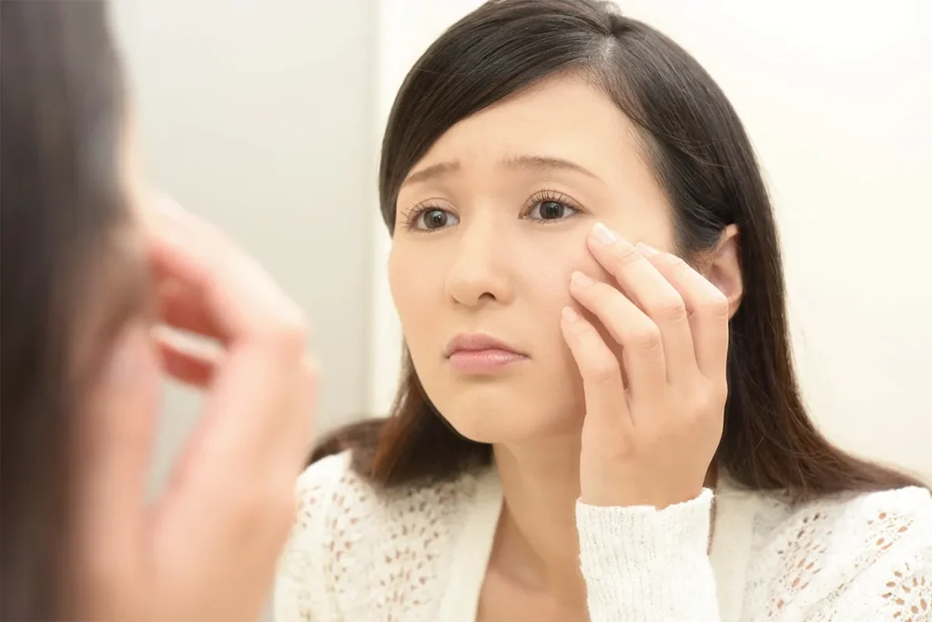 3章. バレやすい糸リフトの特徴と失敗例：こんな仕上がりは要注意