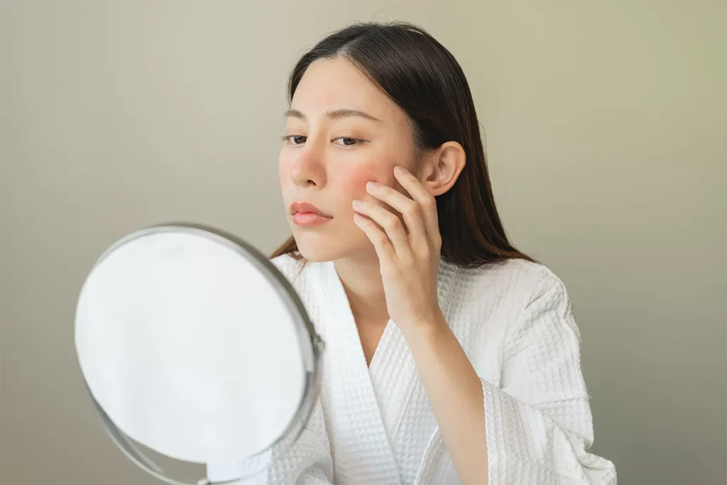第4章. 糸リフトの失敗と痛み:関連する合併症の全体像