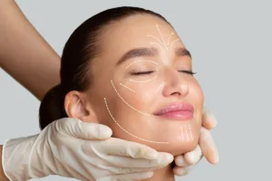 糸リフト6本の効果は？最適な本数と後悔しない選び方を徹底解説