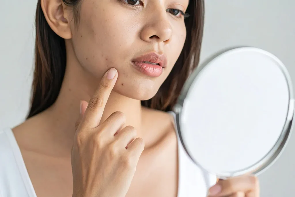 【医師監修】頬コケに糸リフトは逆効果になることも？失敗する4つの原因と後悔しない対策を徹底解説