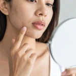 【医師監修】頬コケに糸リフトは逆効果になることも？失敗する4つの原因と後悔しない対策を徹底解説