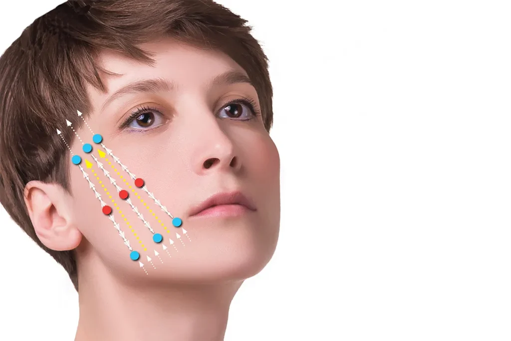 1-3. 糸の固定位置によるつっぱり感や痛み