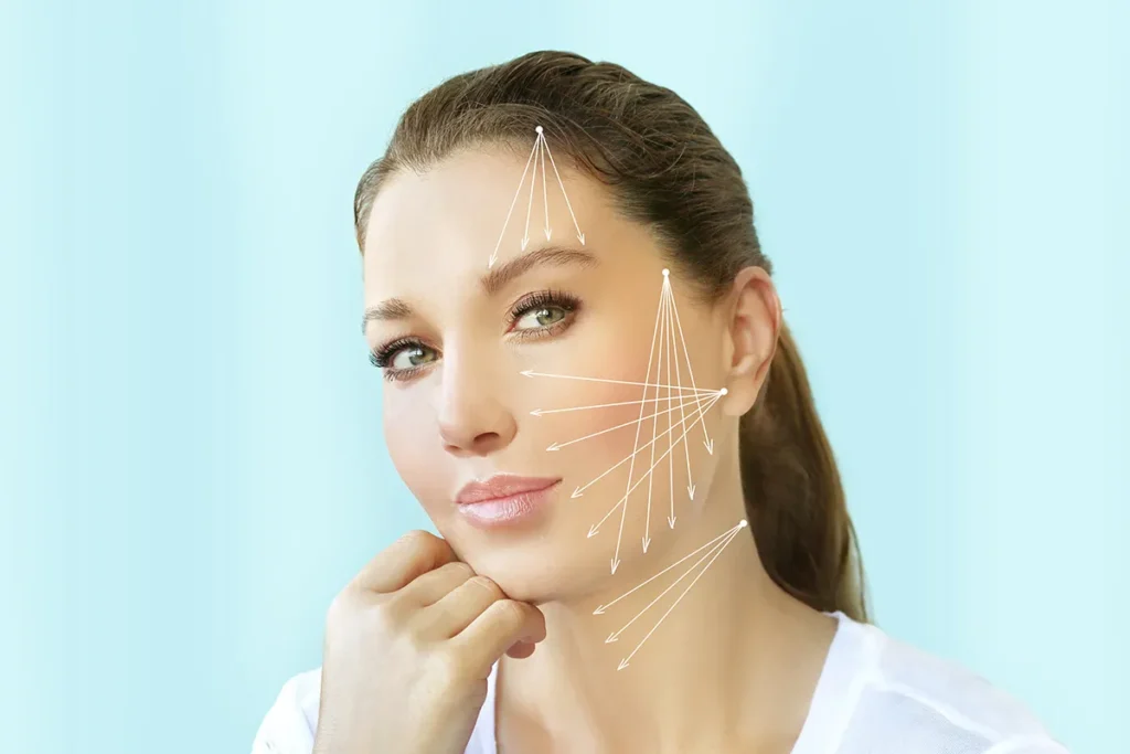 1-2. 糸リフトの2つの効果：即時リフトアップと将来のたるみ予防