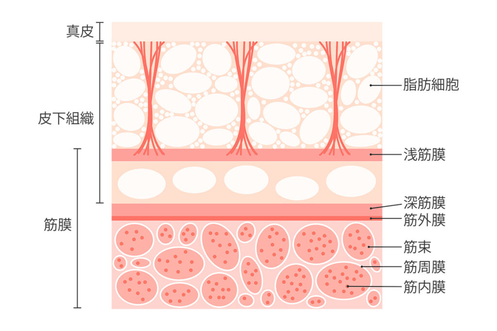第1章 糸リフト後の凹み、その正体とは？