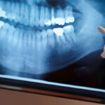 糸リフトはレントゲン・CT・MRIに写る？医療検査での安全性と申告の必要性