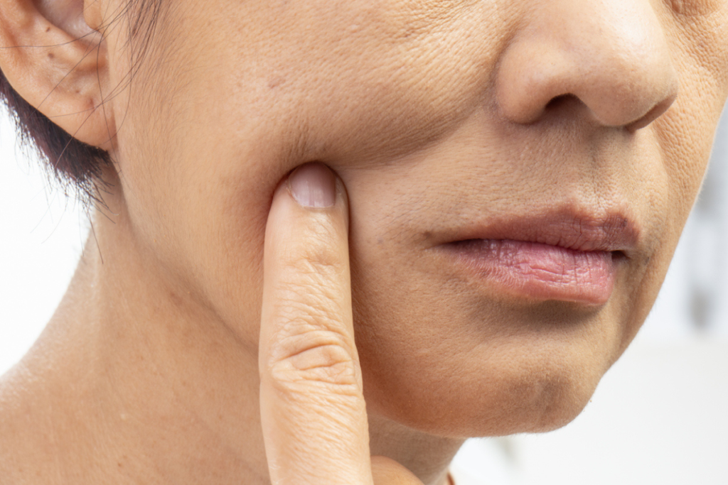 2-2. たるみ治療としての効果が限定的である解剖学的な理由